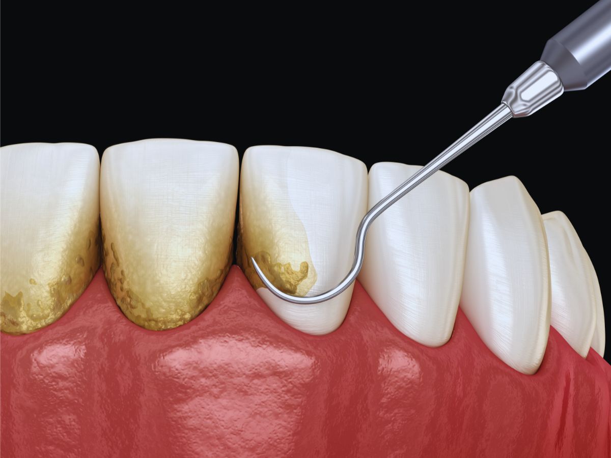 تنظيف الجير