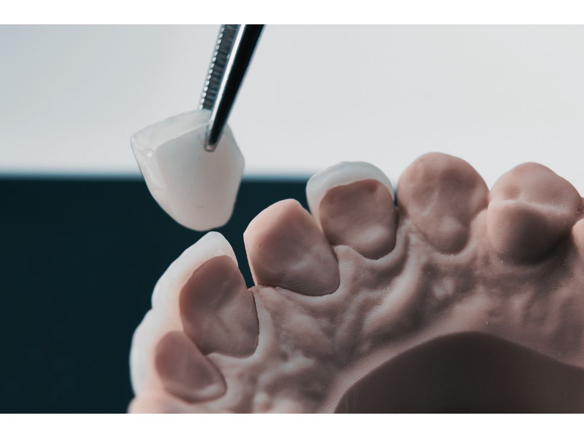 حشوات تجميلية